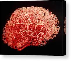 Blood Vessels in the Brain image Blood Vessels in the Brain image